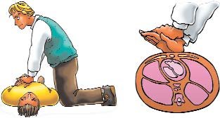  PRIMEROS AUXILIOS (28)  IMAGENES DIBUJOS JPG GALICIA